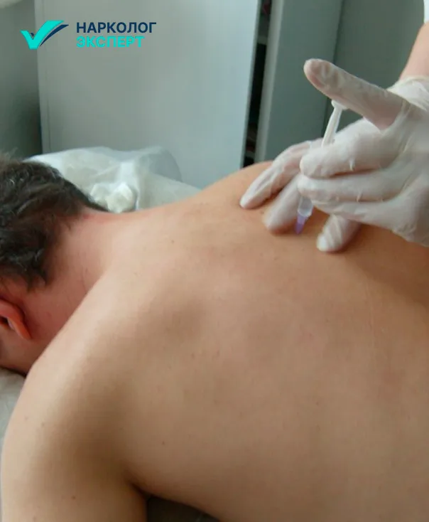 Методы проведения блокировки Препарат для кодирования вшиванием Эспераль