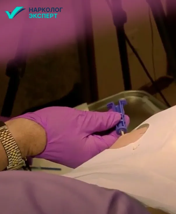 Факторы, влияющие на длительность кодировки Процедура вшивания от алкоголизма